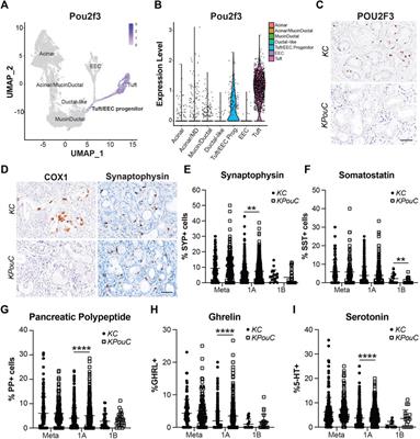 Enteroendocrine Cell Formation Is an Early Event in Pancreatic Tumorigenesis